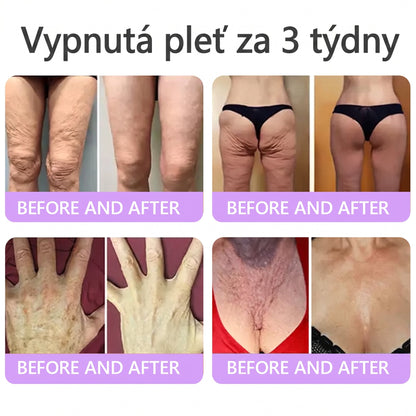Doporučováno dermatology🥇 | 🍊Vitalisys® PDRN Multi-Peptidový masážní tělový krém – Proti stárnutí, hydratační, zpevňující, regenerační, sjednocující, proti akné a skvrnám, na odstraňování bradavic a mateřských znamének, pro úlevu při lupénce.❤️