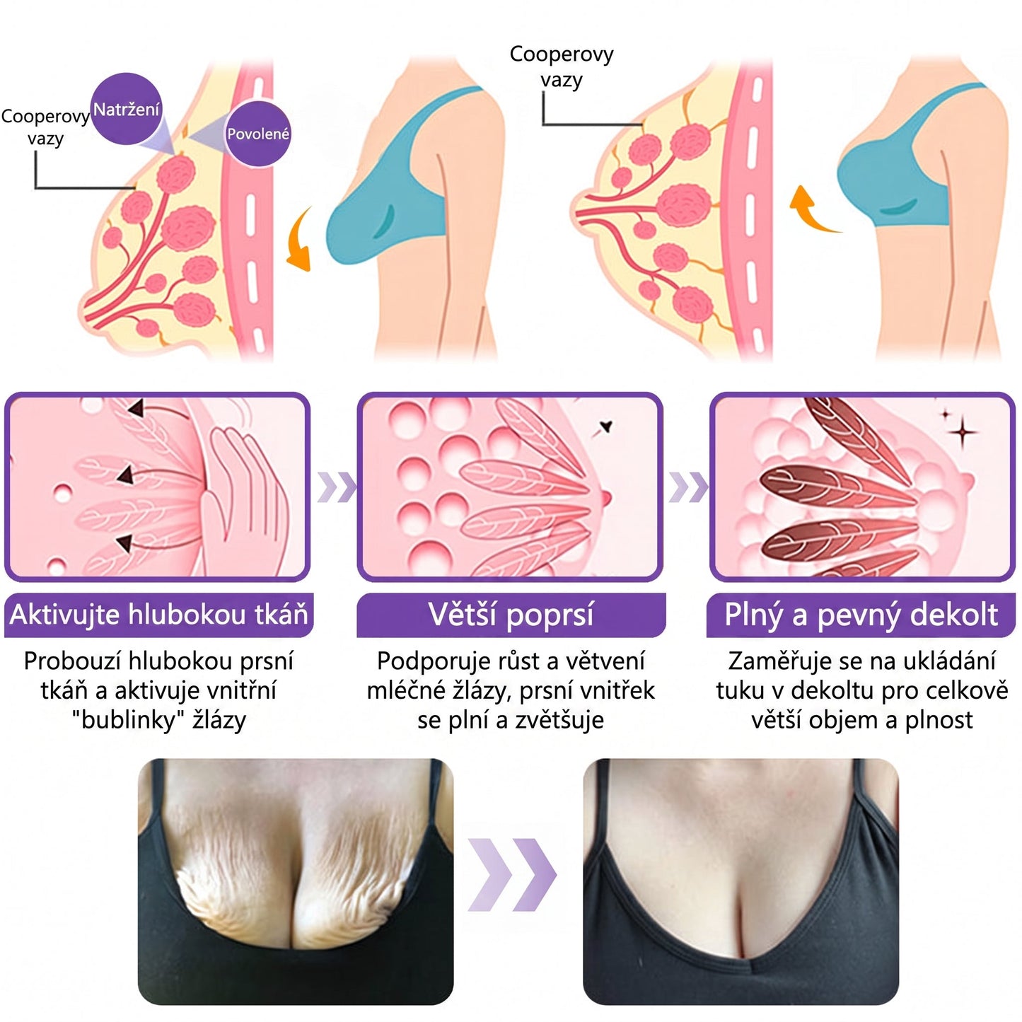 Doporučováno dermatology🥇 | 🍊Vitalisys® PDRN Multi-Peptidový masážní tělový krém – Proti stárnutí, hydratační, zpevňující, regenerační, sjednocující, proti akné a skvrnám, na odstraňování bradavic a mateřských znamének, pro úlevu při lupénce.❤️