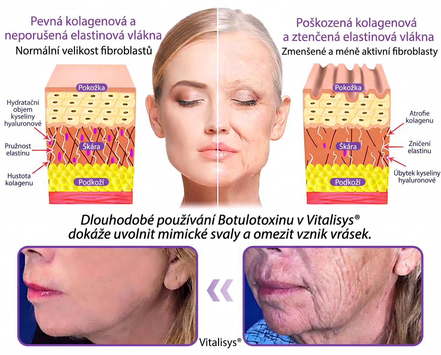 Doporučováno dermatology🥇 | 🍊Vitalisys® PDRN Multi-Peptidový masážní tělový krém – Proti stárnutí, hydratační, zpevňující, regenerační, sjednocující, proti akné a skvrnám, na odstraňování bradavic a mateřských znamének, pro úlevu při lupénce.❤️