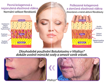 Doporučováno dermatology🥇 | 🍊Vitalisys® PDRN Multi-Peptidový masážní tělový krém – Proti stárnutí, hydratační, zpevňující, regenerační, sjednocující, proti akné a skvrnám, na odstraňování bradavic a mateřských znamének, pro úlevu při lupénce.❤️