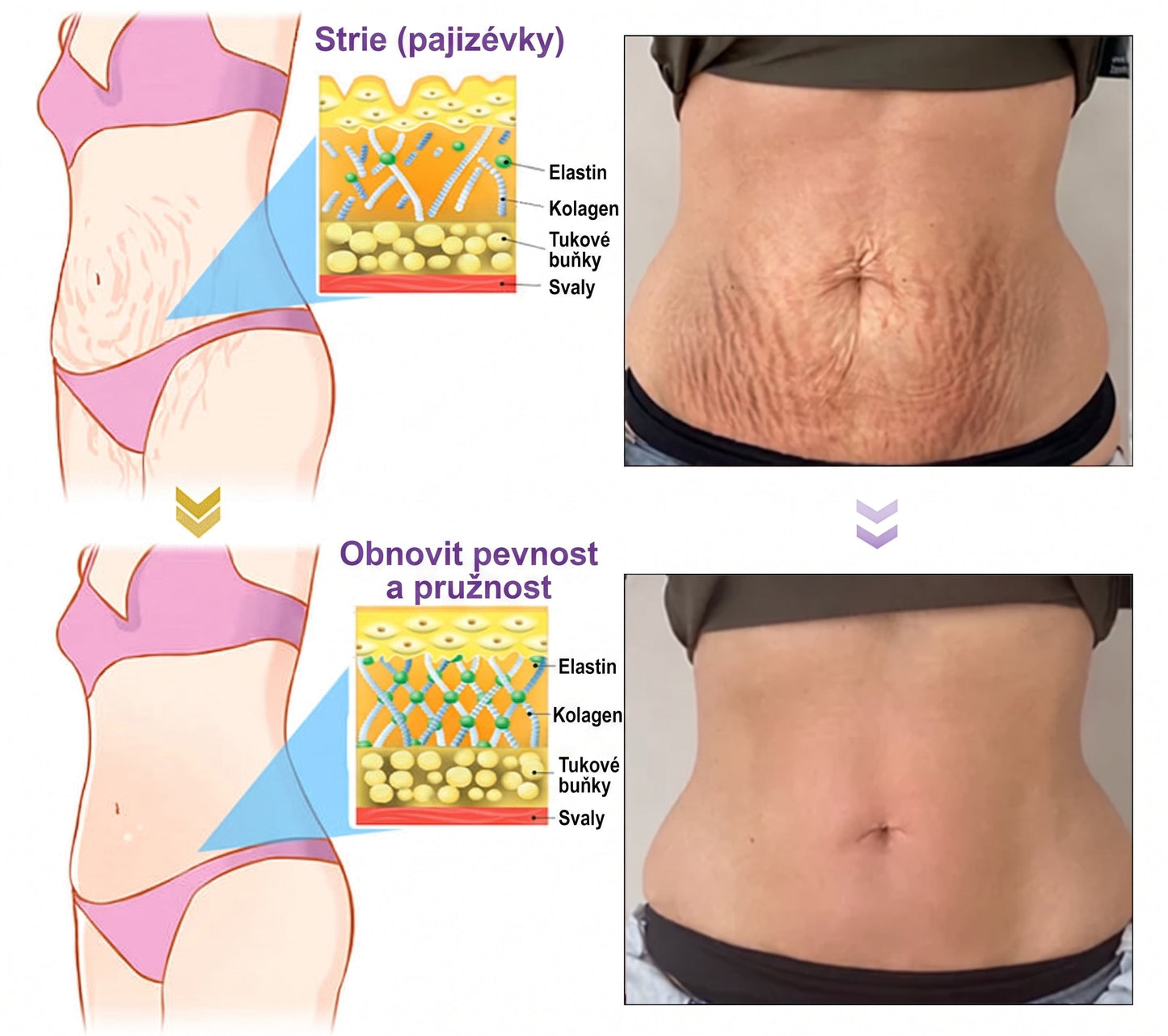 Doporučováno dermatology🥇 | 🍊Vitalisys® PDRN Multi-Peptidový masážní tělový krém – Proti stárnutí, hydratační, zpevňující, regenerační, sjednocující, proti akné a skvrnám, na odstraňování bradavic a mateřských znamének, pro úlevu při lupénce.❤️