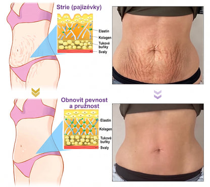 Doporučováno dermatology🥇 | 🍊Vitalisys® PDRN Multi-Peptidový masážní tělový krém – Proti stárnutí, hydratační, zpevňující, regenerační, sjednocující, proti akné a skvrnám, na odstraňování bradavic a mateřských znamének, pro úlevu při lupénce.❤️