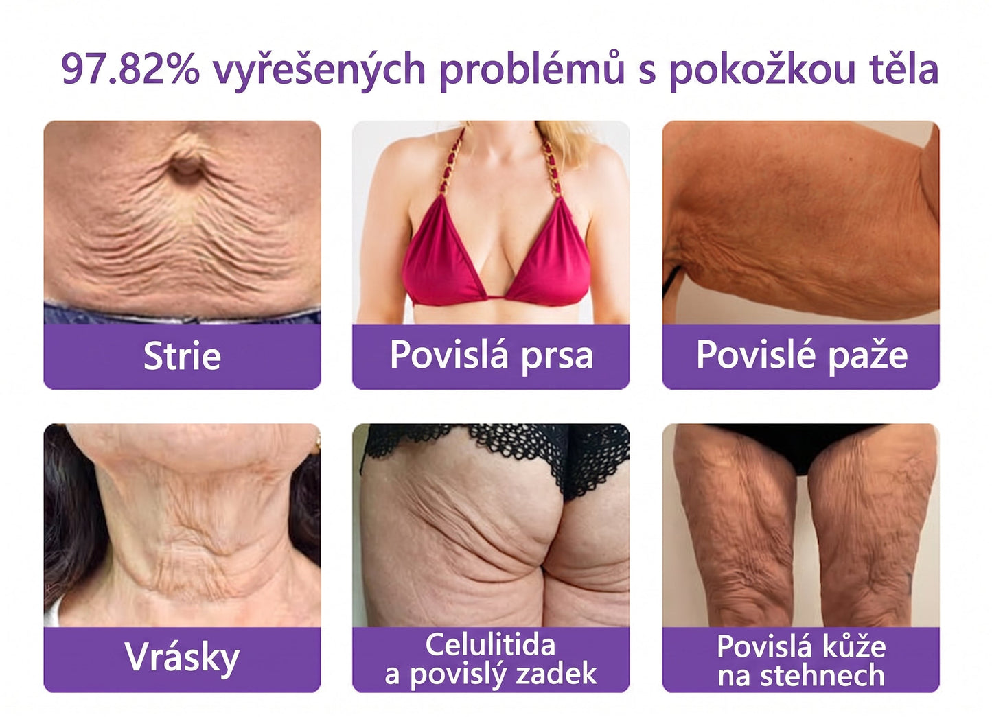 Doporučováno dermatology🥇 | 🍊Vitalisys® PDRN Multi-Peptidový masážní tělový krém – Proti stárnutí, hydratační, zpevňující, regenerační, sjednocující, proti akné a skvrnám, na odstraňování bradavic a mateřských znamének, pro úlevu při lupénce.❤️
