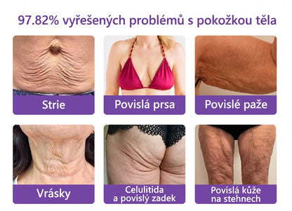 Doporučováno dermatology🥇 | 🍊Vitalisys® PDRN Multi-Peptidový masážní tělový krém – Proti stárnutí, hydratační, zpevňující, regenerační, sjednocující, proti akné a skvrnám, na odstraňování bradavic a mateřských znamének, pro úlevu při lupénce.❤️