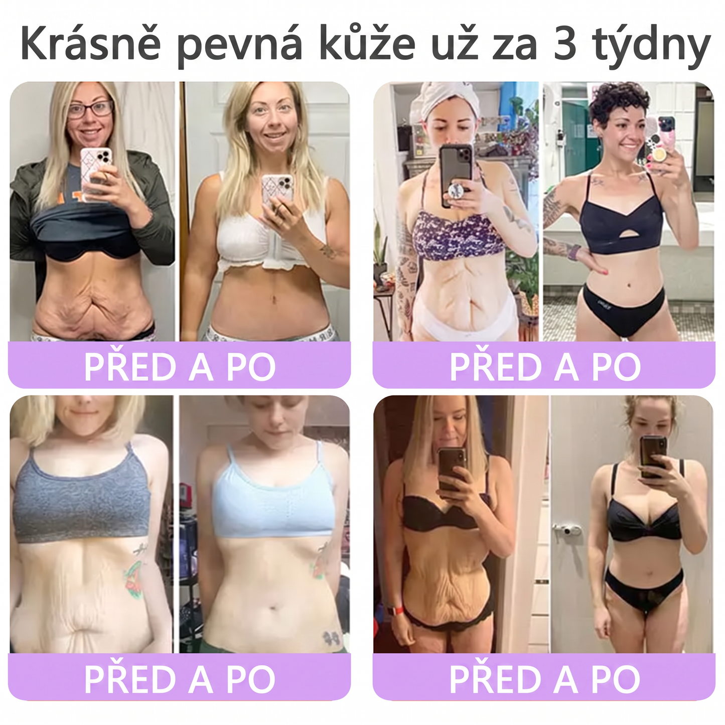 Doporučováno dermatology🥇 | 🍊Vitalisys® PDRN Multi-Peptidový masážní tělový krém – Proti stárnutí, hydratační, zpevňující, regenerační, sjednocující, proti akné a skvrnám, na odstraňování bradavic a mateřských znamének, pro úlevu při lupénce.❤️