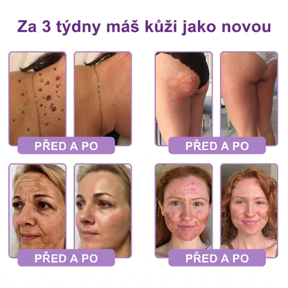 Doporučováno dermatology🥇 | 🍊Vitalisys® PDRN Multi-Peptidový masážní tělový krém – Proti stárnutí, hydratační, zpevňující, regenerační, sjednocující, proti akné a skvrnám, na odstraňování bradavic a mateřských znamének, pro úlevu při lupénce.❤️
