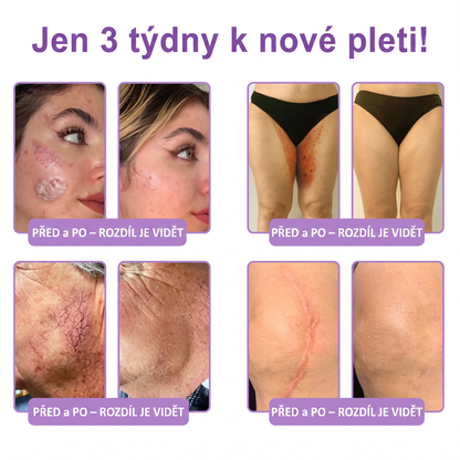 Doporučováno dermatology🥇 | 🍊Vitalisys® PDRN Multi-Peptidový masážní tělový krém – Proti stárnutí, hydratační, zpevňující, regenerační, sjednocující, proti akné a skvrnám, na odstraňování bradavic a mateřských znamének, pro úlevu při lupénce.❤️