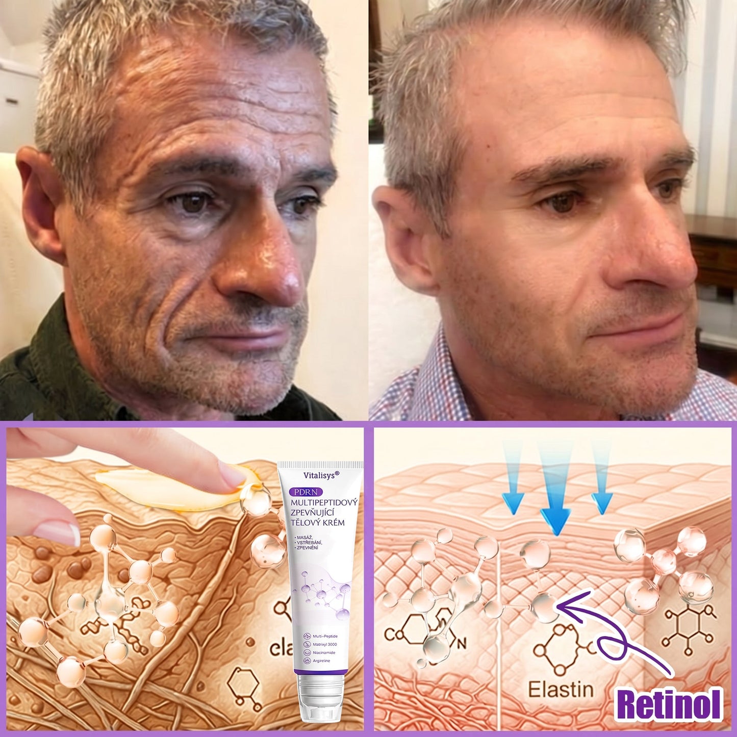 Doporučováno dermatology🥇 | 🍊Vitalisys® PDRN Multi-Peptidový masážní tělový krém – Proti stárnutí, hydratační, zpevňující, regenerační, sjednocující, proti akné a skvrnám, na odstraňování bradavic a mateřských znamének, pro úlevu při lupénce.❤️